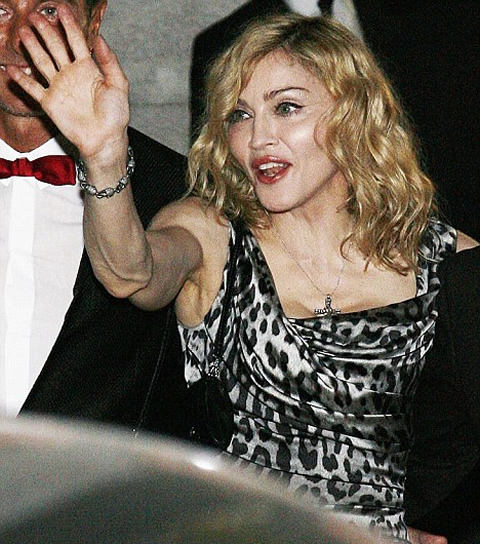 madonna-scary-arm.jpg